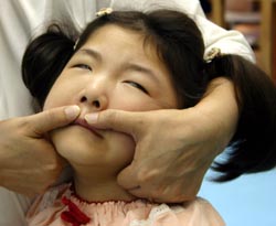 お口のストレッチも